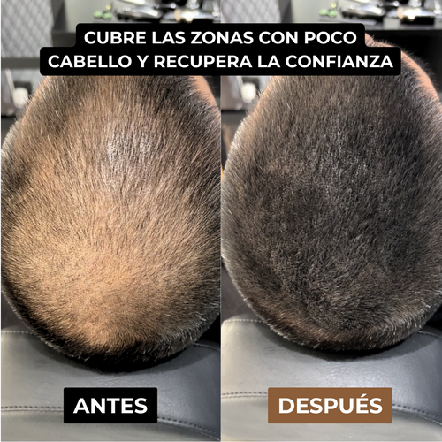 Camuflaje Capilar Solvera™