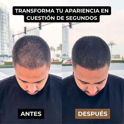 Camuflaje Capilar Solvera™