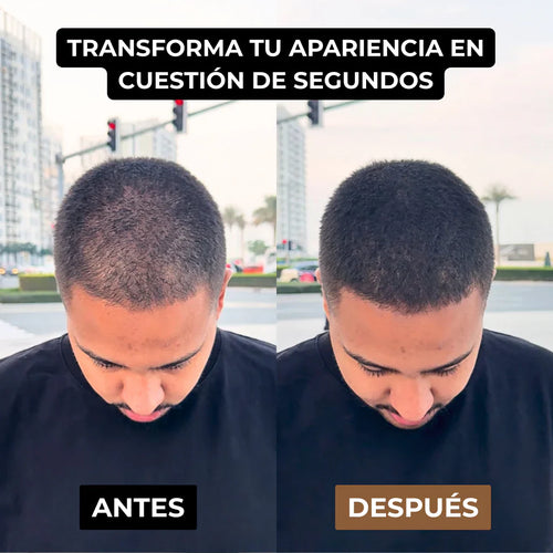 Camuflaje Capilar Solvera™